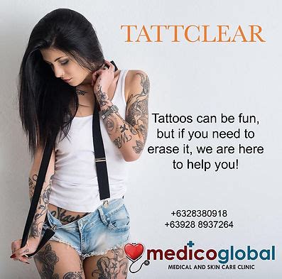 tattoo removal philippines|Tattclear Manila.
